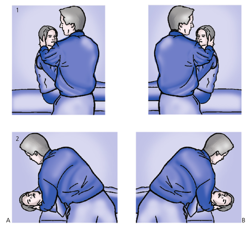 A Dix Hallpike positioning maneuver to the right B Dix Hallpike maneuver to the.ppm